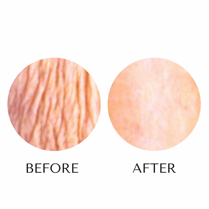 Crepe Skin Miracle Body Mousse, , large