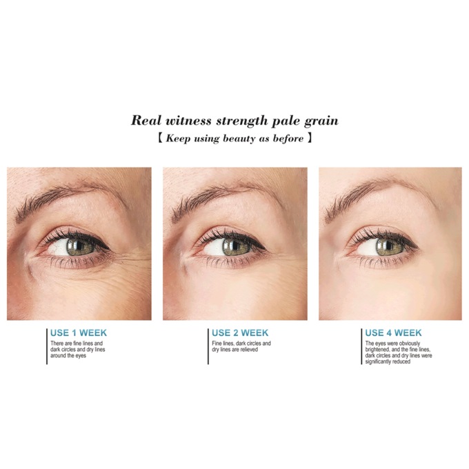 Amoré Retinol Eye Cream, , large