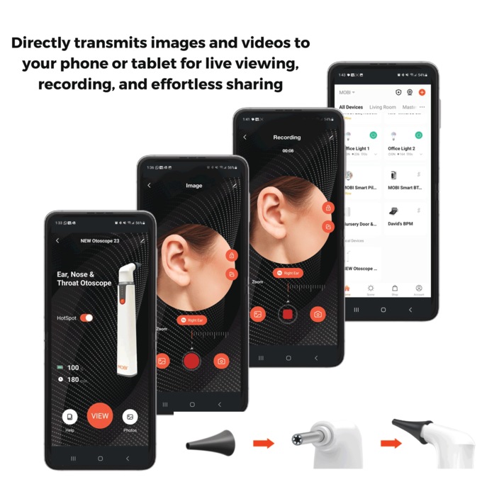 Mobi Smart Ear, Nose & Throat Otoscope, , large
