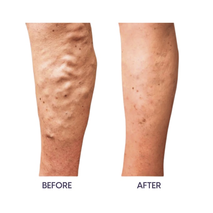 Vari-Smooth Leg Cream, , large