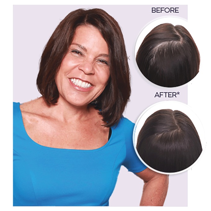 Keranique Hair Regrowth Treatment, , large
