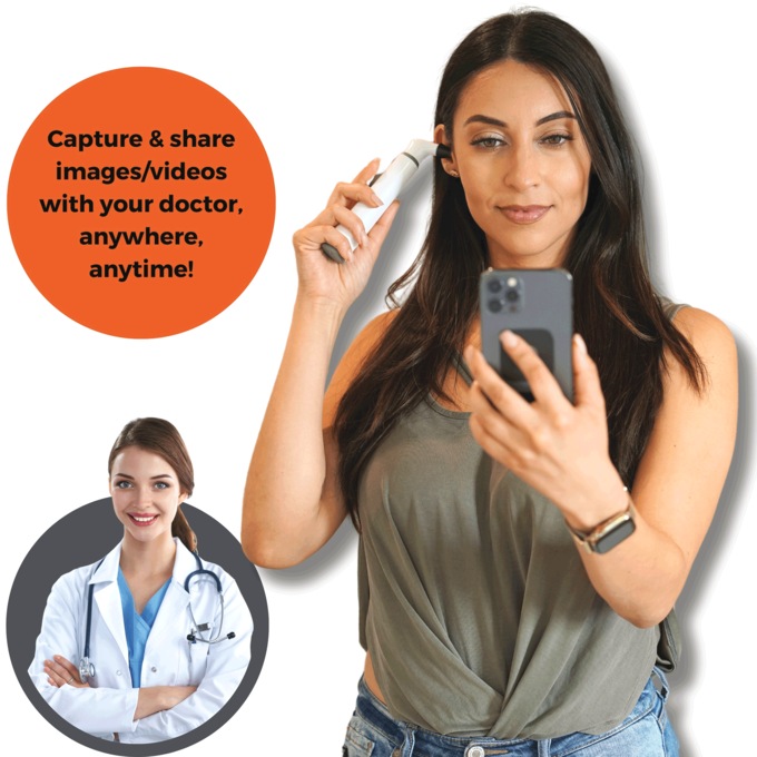 Mobi Smart Ear, Nose & Throat Otoscope, , large