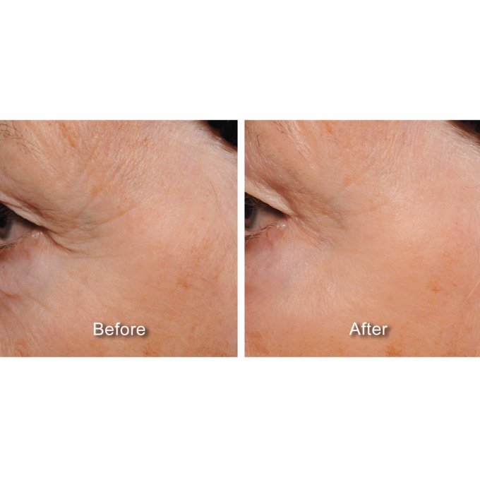 Sea Cell Anti-Aging Complex, , large