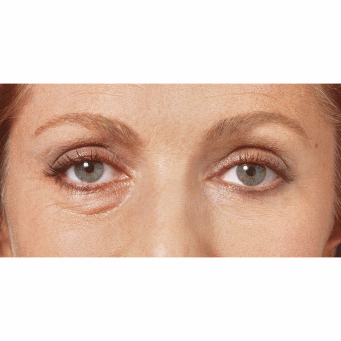 Sudden Change Under-Eye Serum , , large